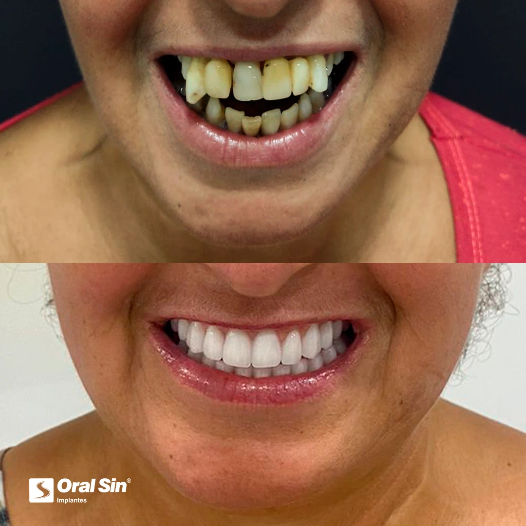 Esteio-antes-e-depois.webp